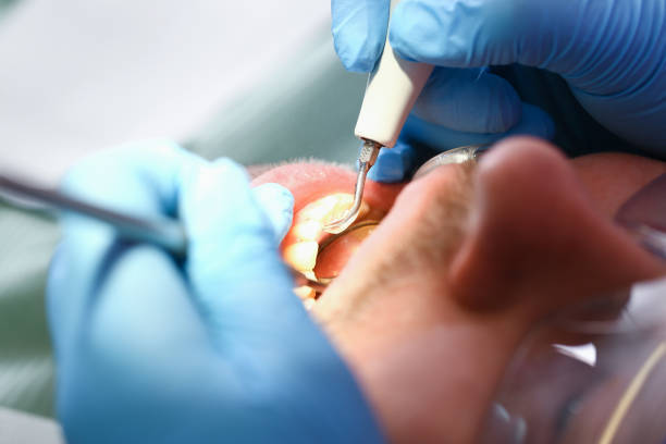 Best Broken or Cracked Tooth Emergency Dentist in West Middlesex, PA