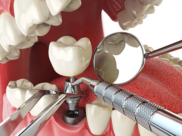 Best Broken or Cracked Tooth Emergency Dentist in West Middlesex, PA